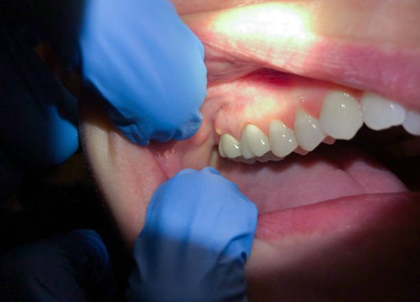  Fairchild Af, WA Emergency Dentist Pros