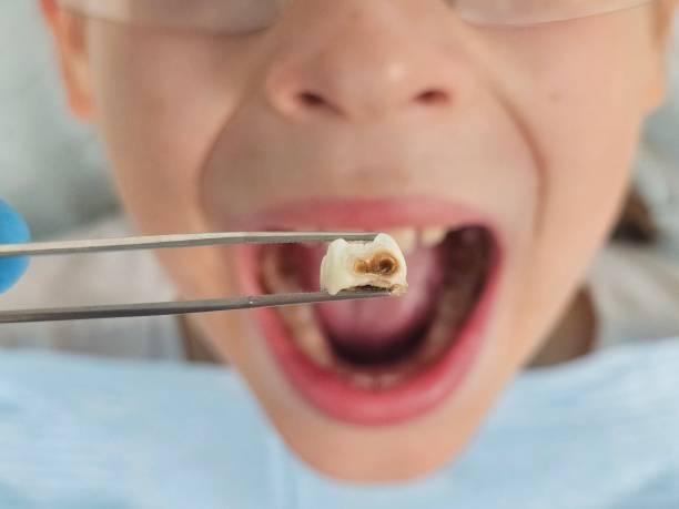 Best Affordable Emergency Dental Care  in Fairchild Af, WA